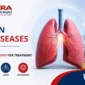 Common Lung Diseases Why You Need the Best Hospital in Sonipat for Treatment 85x85