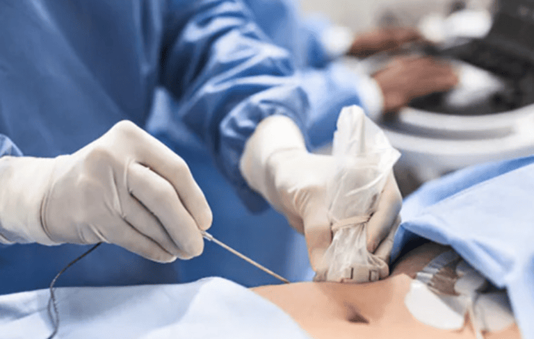 Interventional Radiology