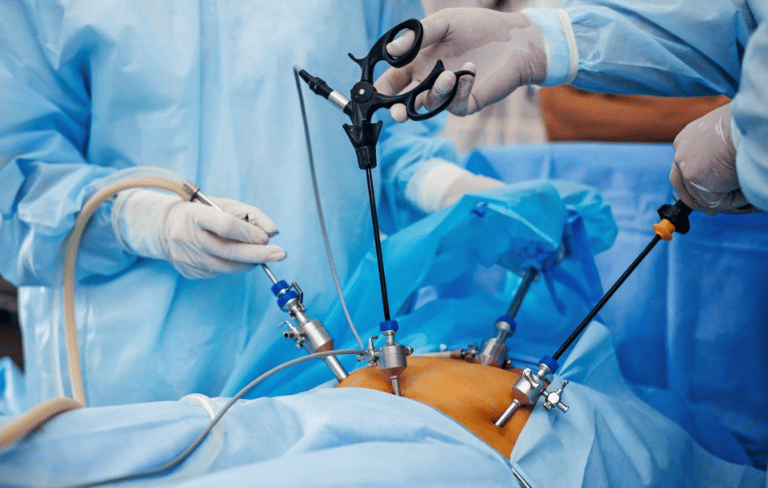 Laparoscopic Surgery